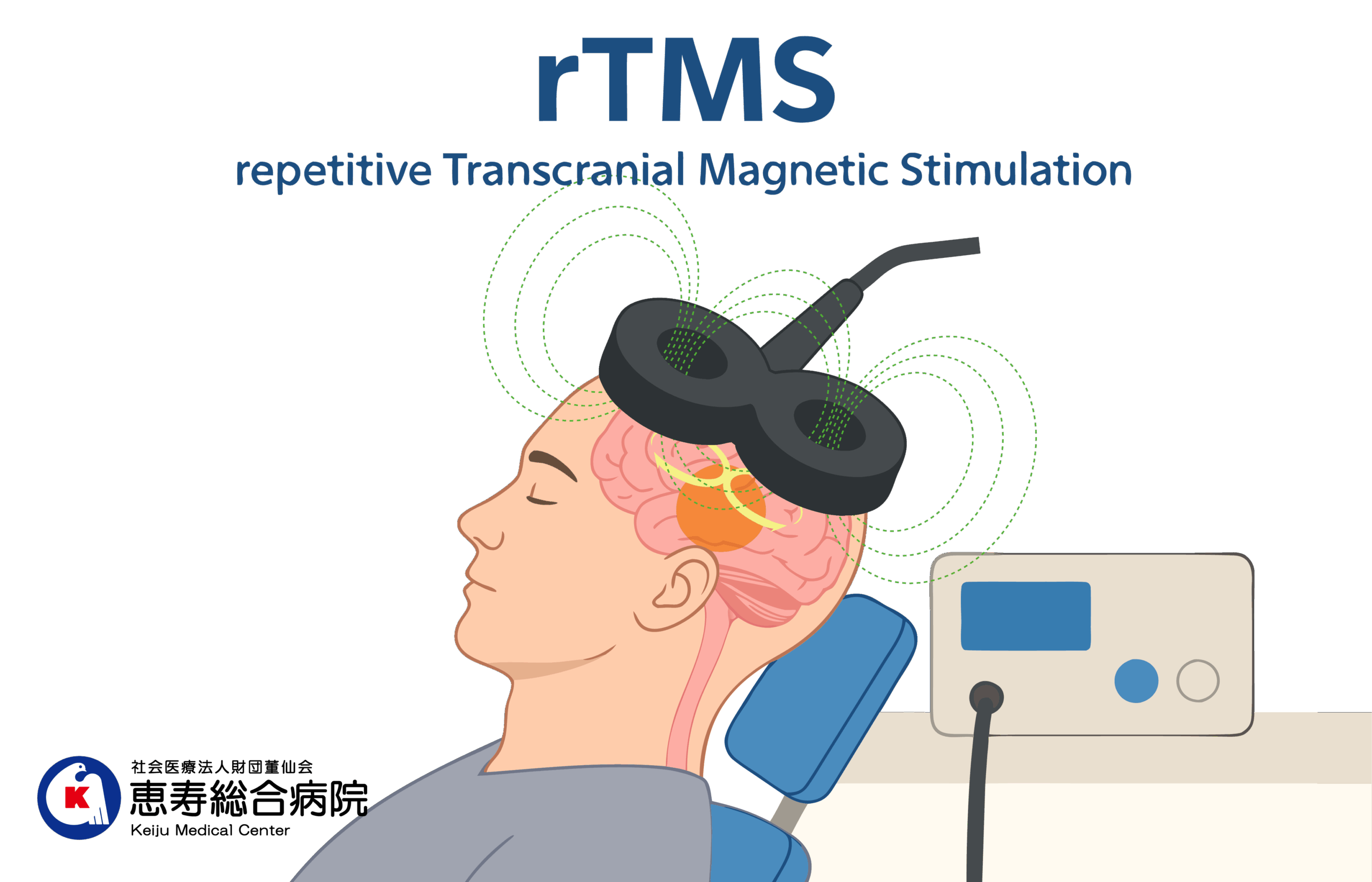 rTMS治療の様子